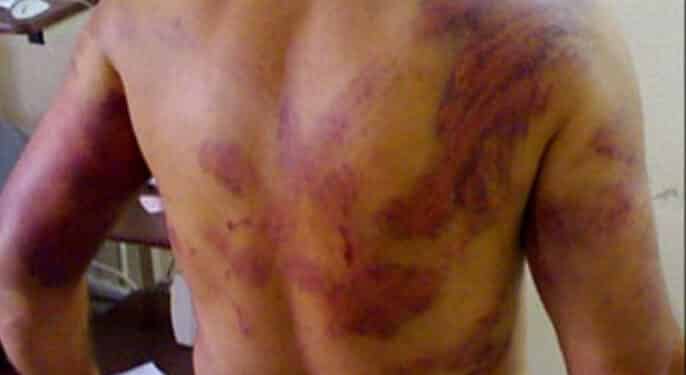 التعذيب في سجون السلطة الفلسطينية