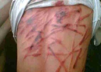 وباء التعذيب والإهمال الطبي يحصد المزيد من أرواح المعتقلين في السجون المصرية