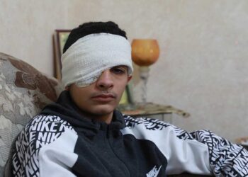 طفل فلسطيني فقد عينه برصاصة إسرائيلية
