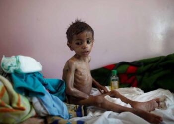 خطر المجاعة في اليمن