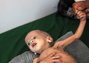 شبح المجاعة يتهدد ملايين اليمنيين