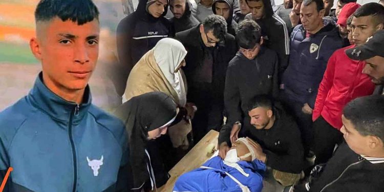 16-year-old Montasir Al-Shawwa was injured by the IOF live bullets during an Israeli military raid into Balata refugee camp