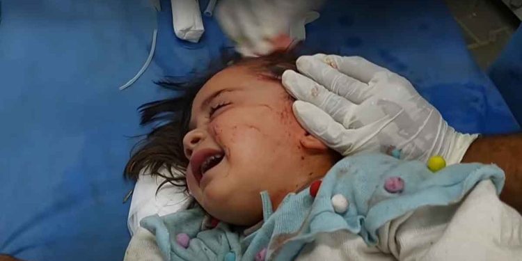 35 قتيلا في مجزرة إسرائيلية بمخيم للنازحين في رفح