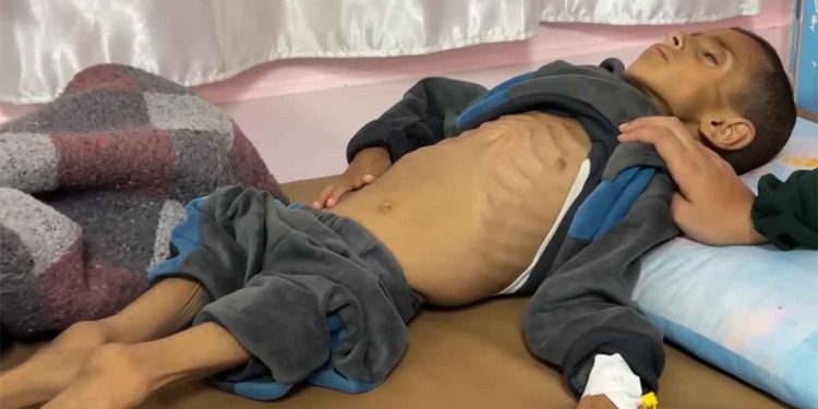 المجاعة تفتك بسكان غزة.. والاحتلال يواصل حصاره الهمجي