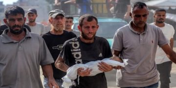 وفاة طفل في غزة بسبب الجوع وسوء التغذية الحاد