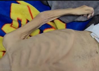 أطفال غزة في مواجهة الموت جوعاً.. ولا نهاية في الأفق