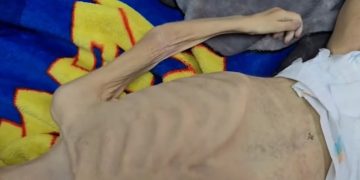 أطفال غزة في مواجهة الموت جوعاً.. ولا نهاية في الأفق