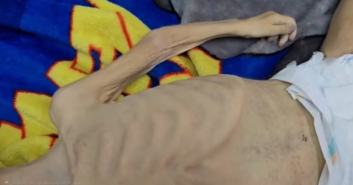 أطفال غزة في مواجهة الموت جوعاً.. ولا نهاية في الأفق