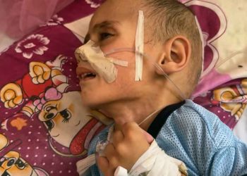 سوء التغذية يفتك بأطفال غزة