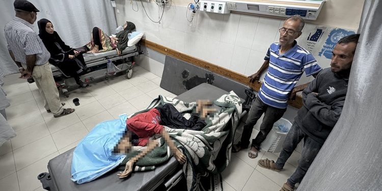 غزة.. الفتاة رحيل رصرص تفقد نصف وزنها قبل أن يجهز عليها الجوع