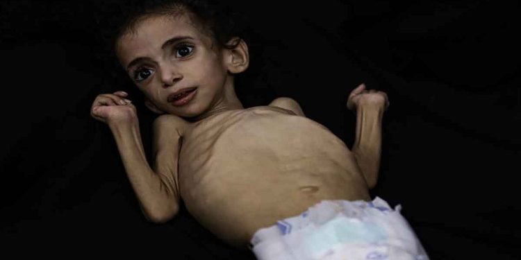 لا بد من إجراءات عملية لإنقاذ سكان قطاع غزة  