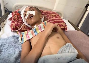 217 وفاة بينهم 100 طفل في غزة جراء التجويع المستمر