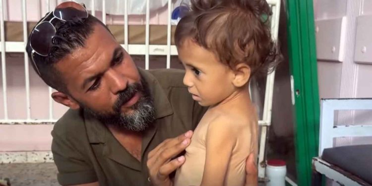 اليونيسيف: 112 طفلاً يدخلون يومياً دائرة سوء التغذية في غزة