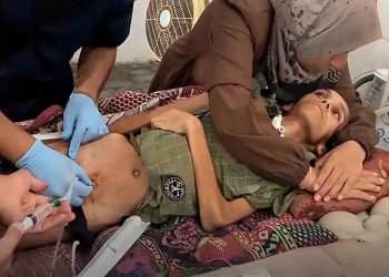 بسبب التجويع والحصار.. 3 وفيات جديدة بمتلازمة “غيلان باريه” في غزة