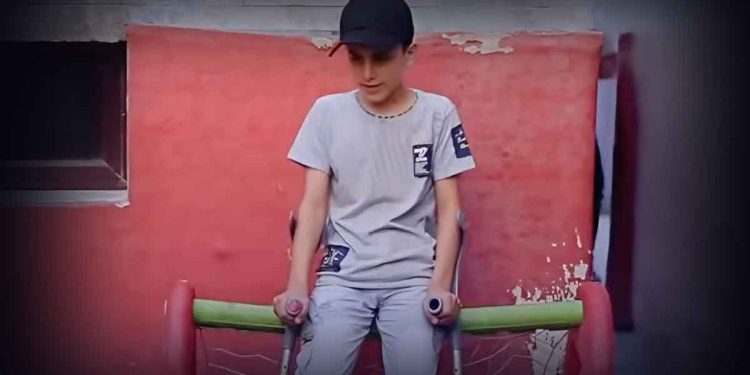 21 ألف طفل في غزة يعانون إعاقات دائمة تحت نار الإبادة الجماعية