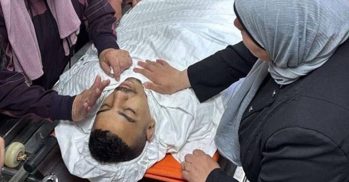 الفلسطيني محمد أبو حنين يفارق الحياة متأثراً بإصابته برصاص الاحتلال في نابلس