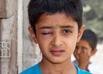 17 ألف إصابة في العيون بغزة.. فقدان البصر كسلاح إضافي في الحرب