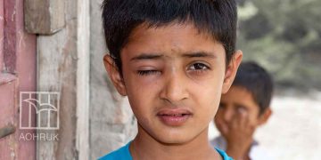 17 ألف إصابة في العيون بغزة.. فقدان البصر كسلاح إضافي في الحرب